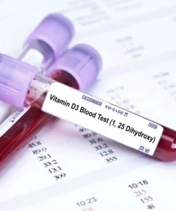 VITAMIN D, 1,25 DIHYDROXY, SERUM