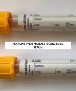 ALKALINE PHOSPHATASE ISOENZYMES, SERUM
