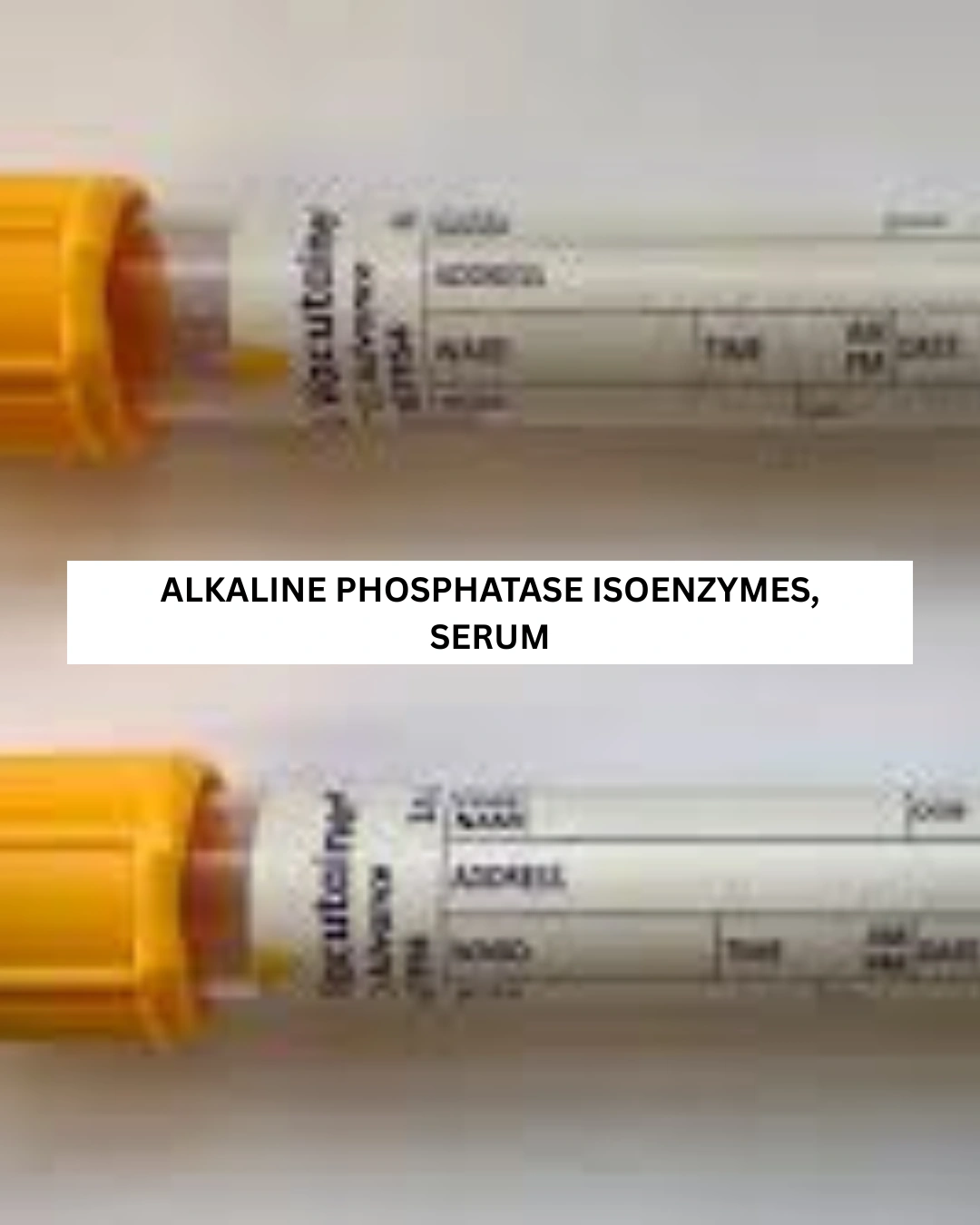 ALKALINE PHOSPHATASE ISOENZYMES, SERUM