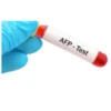 ALPHA FETO PROTEIN(AFP), CANCER MARKER,SERUM