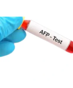 ALPHA FETO PROTEIN(AFP), CANCER MARKER,SERUM