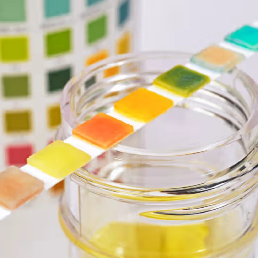 URINE SUGAR, FASTING