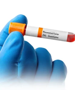 Rheumatoid Factor Quantitative, Serum
