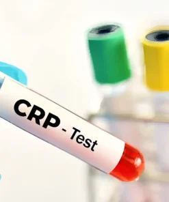 C-REACTIVE PROTEIN (QUALITATIVE), SERUM