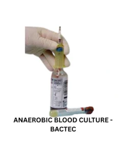 ANAEROBIC BLOOD CULTURE - BACTEC