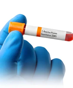 C-REACTIVE PROTEIN (QUANTITATIVE), SERUM