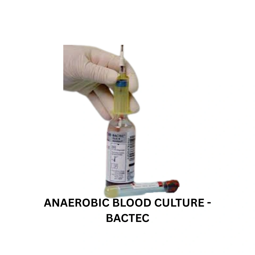 ANAEROBIC BLOOD CULTURE - BACTEC
