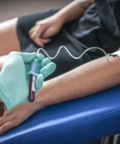 Rpr-Rapid Plasma Reagin (Syphilis Antibody), Test