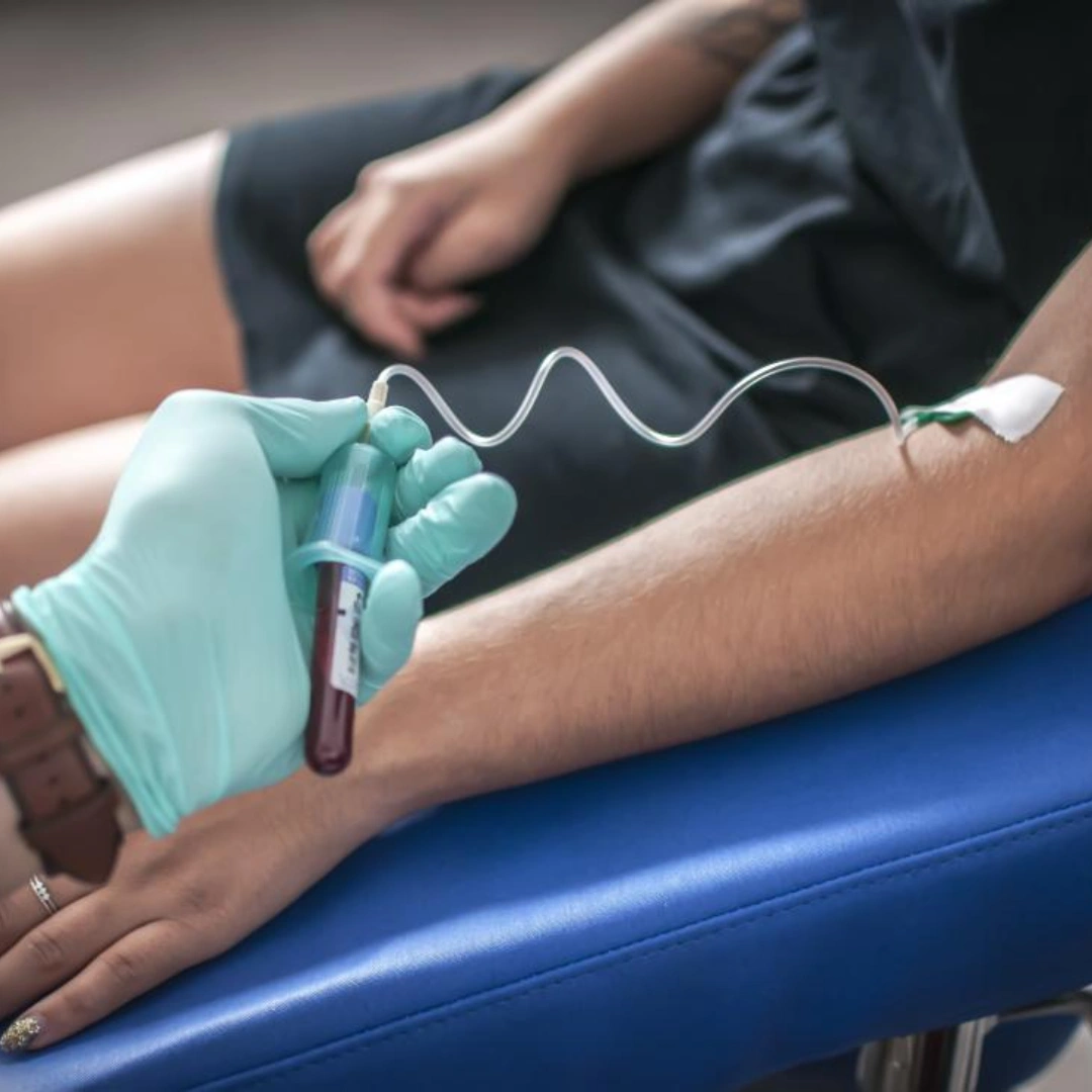 Rpr-Rapid Plasma Reagin (Syphilis Antibody), Test