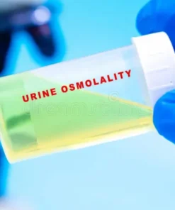 URINE OSMOLALITY