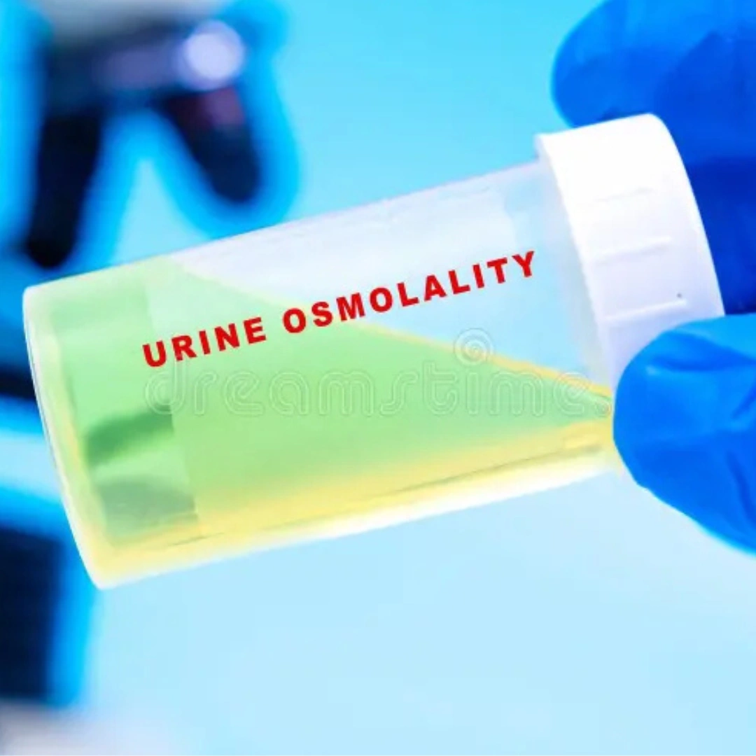 URINE OSMOLALITY