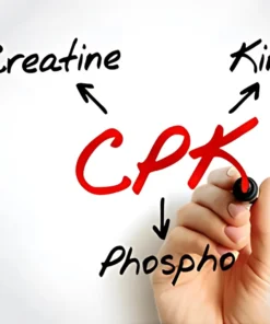 CREATINE PHOSPHOKINASE -MB,SERUM
