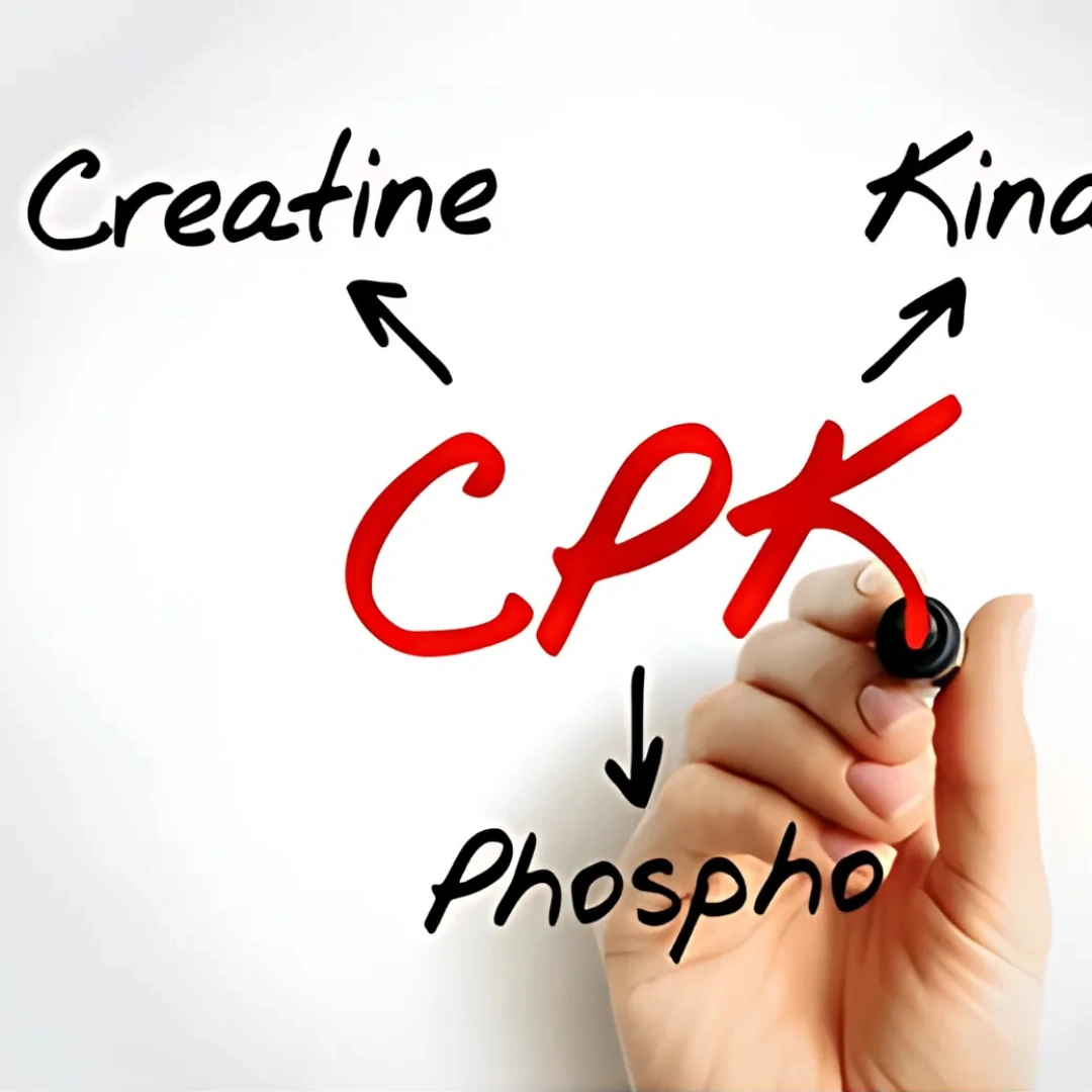 CREATINE PHOSPHOKINASE -MB,SERUM