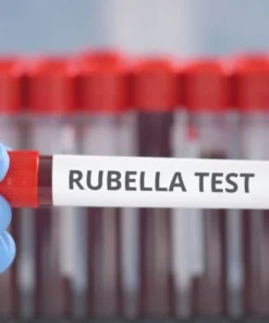 Rubella Igm, Serum