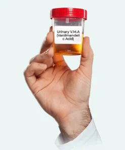 VANILLYLMANDELIC ACID 24 HRS(VMA)