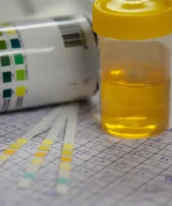 URIC ACID, RANDOM URINE