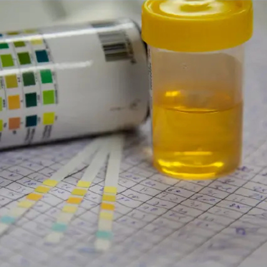 URINE FOR REDUCING SUBSTANCES