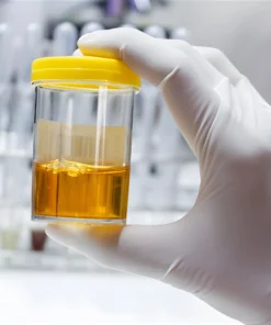 CREATININE, 24 HRS URINE