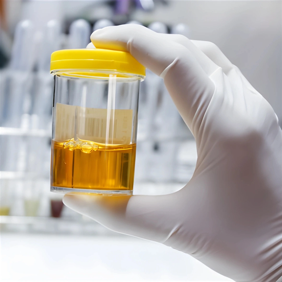 CREATININE, 24 HRS URINE