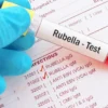 Rubella Igg, Serum