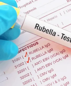 Rubella Igg, Serum