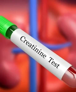 CREATININE, RANDOM URINE