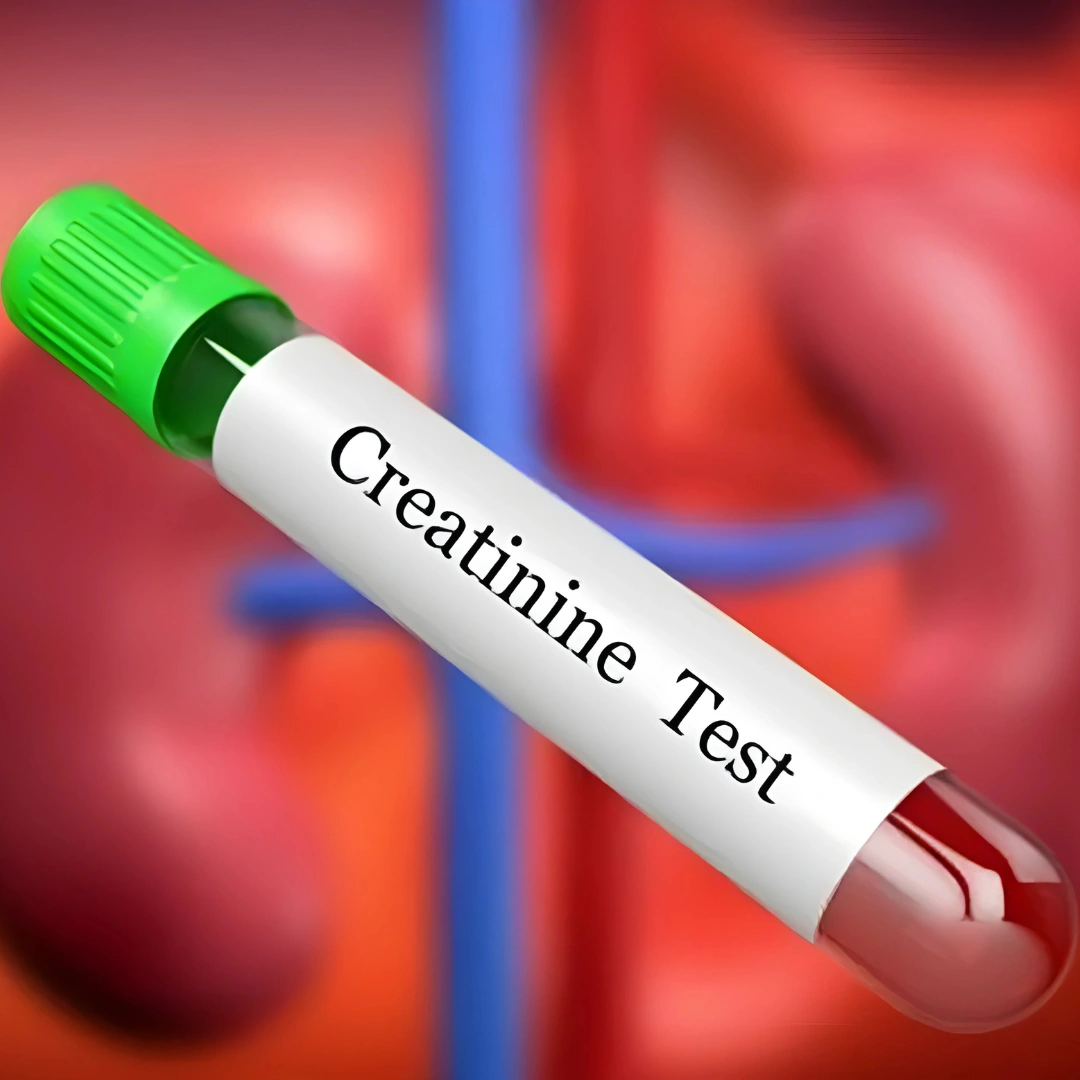 CREATININE, RANDOM URINE