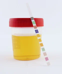 AMPHETAMINE, URINE