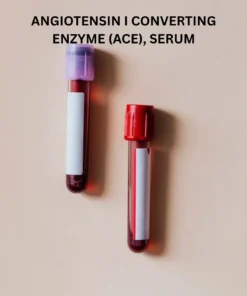 ANGIOTENSIN I CONVERTING ENZYME (ACE), SERUM