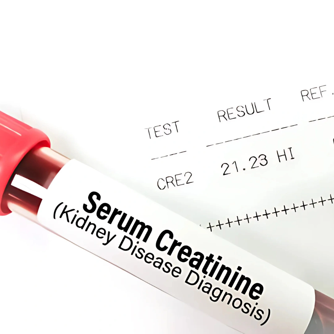 CREATININE, SERUM