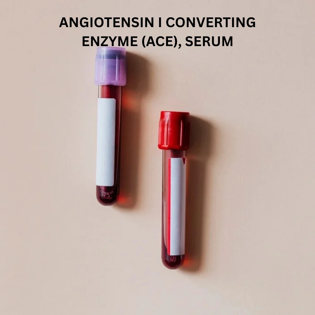 ANGIOTENSIN I CONVERTING ENZYME (ACE), SERUM