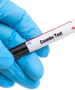 COOMBS DIRECT (DCT), WHOLE BLOOD