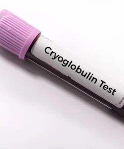 CRYOGLOBULIN- QUALITATIVE