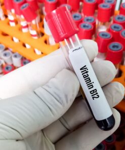 VITAMIN B12, SERUM