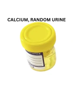 CALCIUM, RANDOM URINE