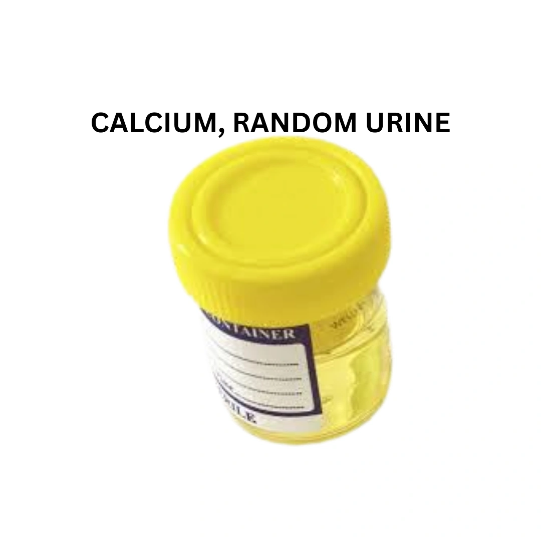 CALCIUM, RANDOM URINE