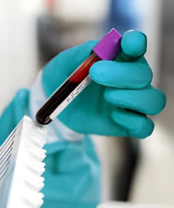 CARCINO EMBRYONIC ANTIGEN (CEA), SERUM