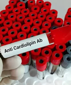 CARDIOLIPIN (ACL) IGA ANTIBODIES