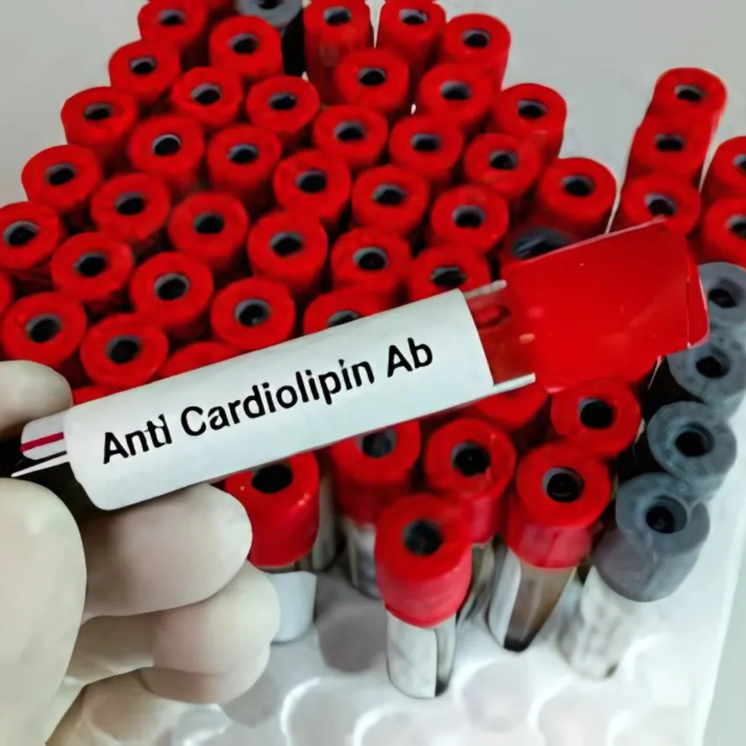 CARDIOLIPIN (ACL) IGA ANTIBODIES