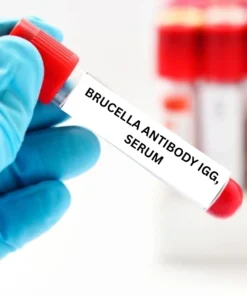 BRUCELLA ANTIBODY IGG, SERUM