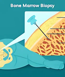 BONE MARROW EXAMINATION