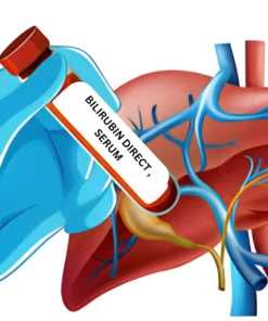 BILIRUBIN DIRECT , SERUM