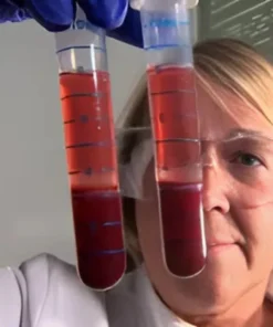 ALCOHOL (ETHANOL), SERUM