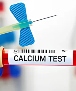 CALCIUM, SERUM