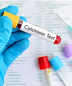 CALCITONIN, SERUM