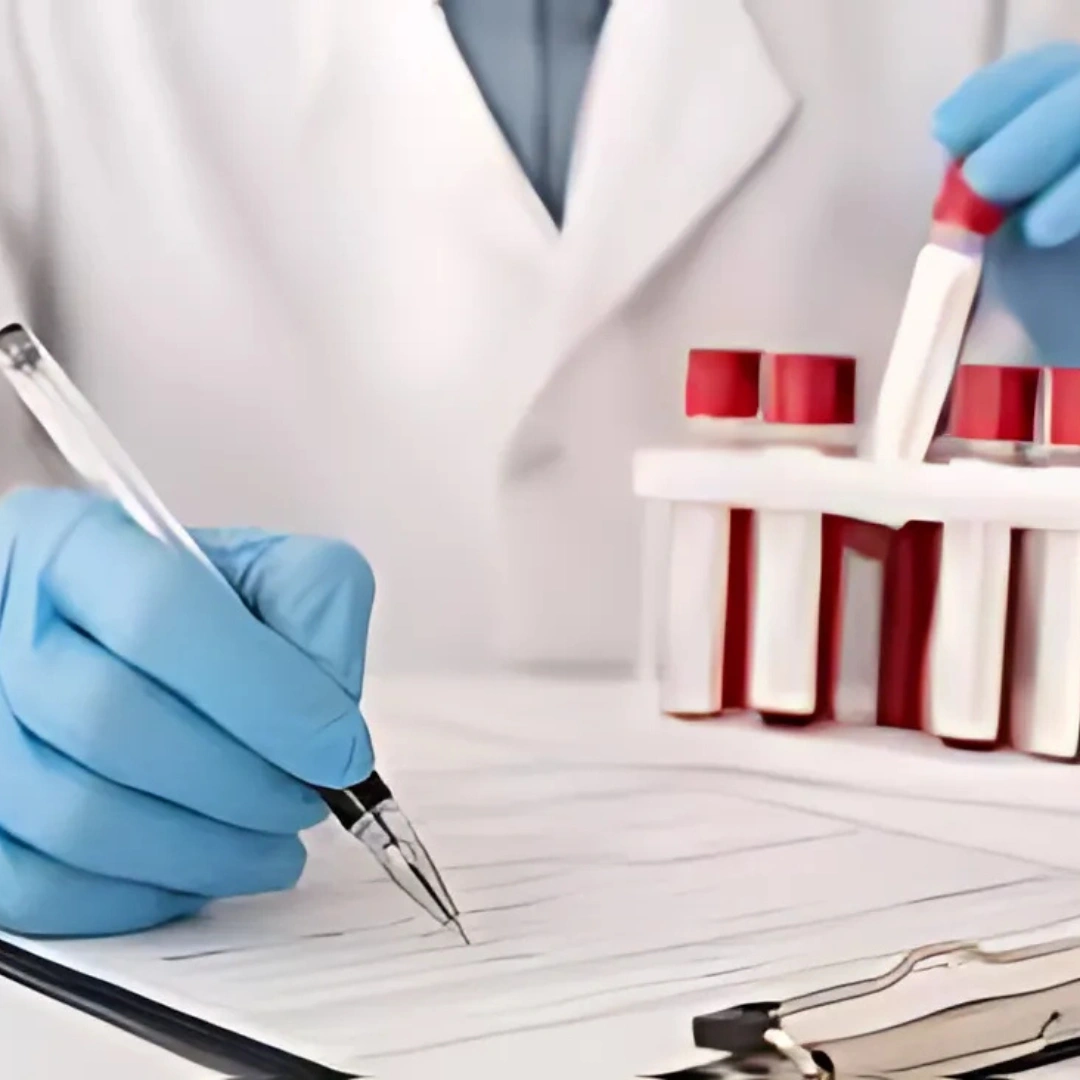 CA-19-9, CANCER MARKER, SERUM