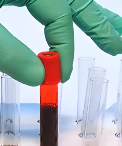 CERULOPLASMIN, SERUM