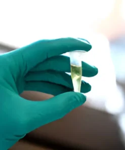 CEREBROSPINAL FLUID, ROUTINE EXAMINATION