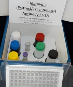 CHLAMYDIA TRACHOMATIS ANTIBODY, IGG, SERUM