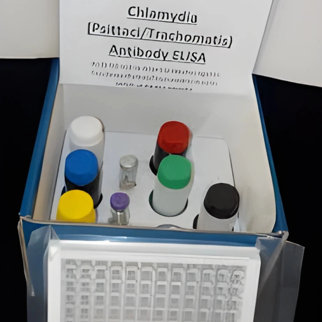 CHLAMYDIA TRACHOMATIS ANTIBODY, IGG, SERUM